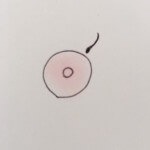 乳首脱毛